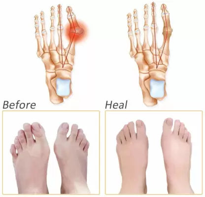 Soft Silicon Gel Half Toe